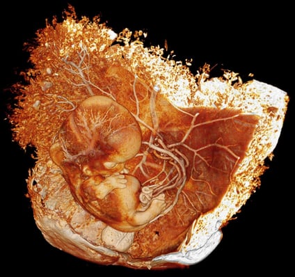 embyro-micro-ct