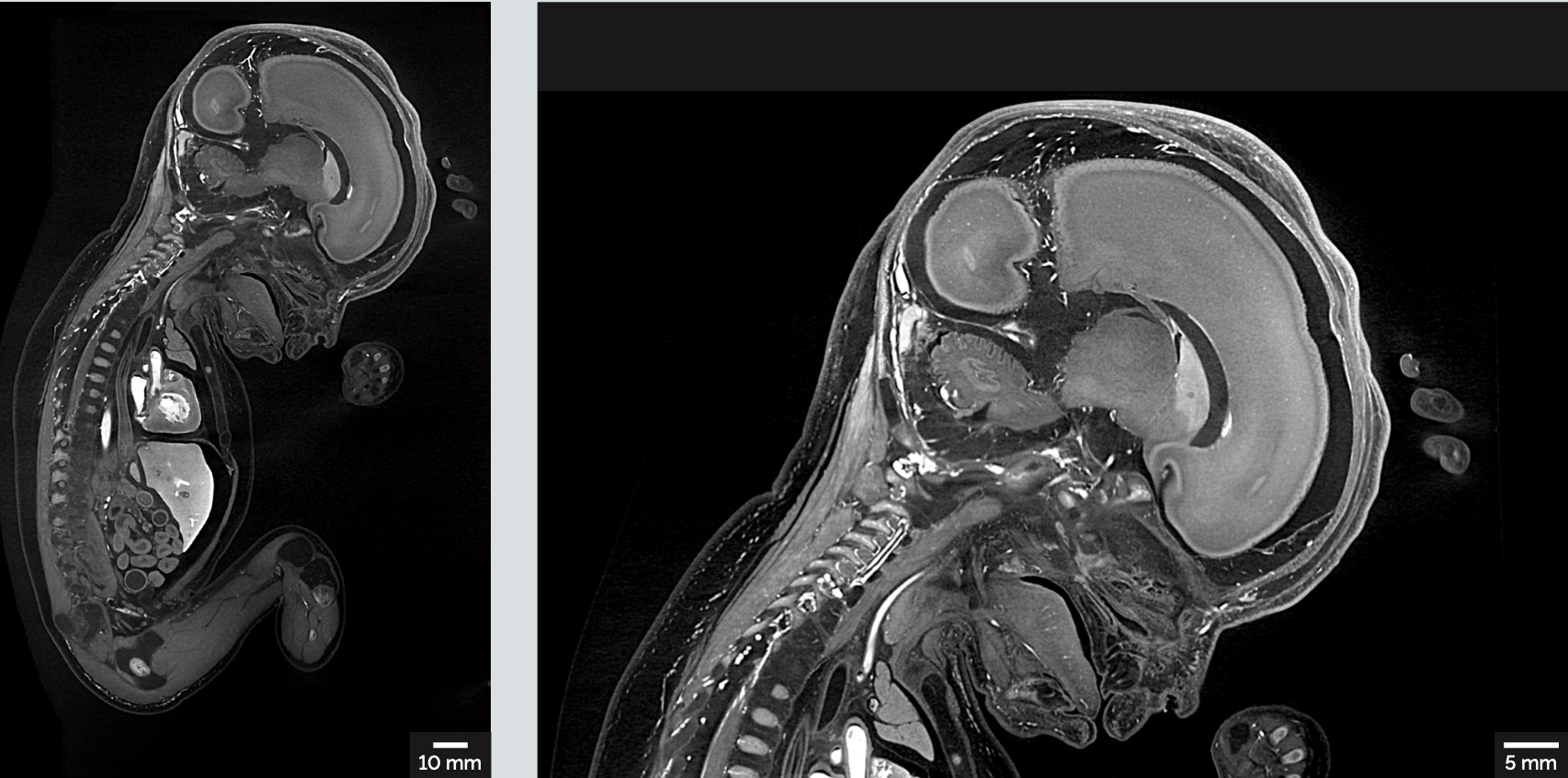 Unveiling the Secrets of Early Human Development through Micro-CT Imaging